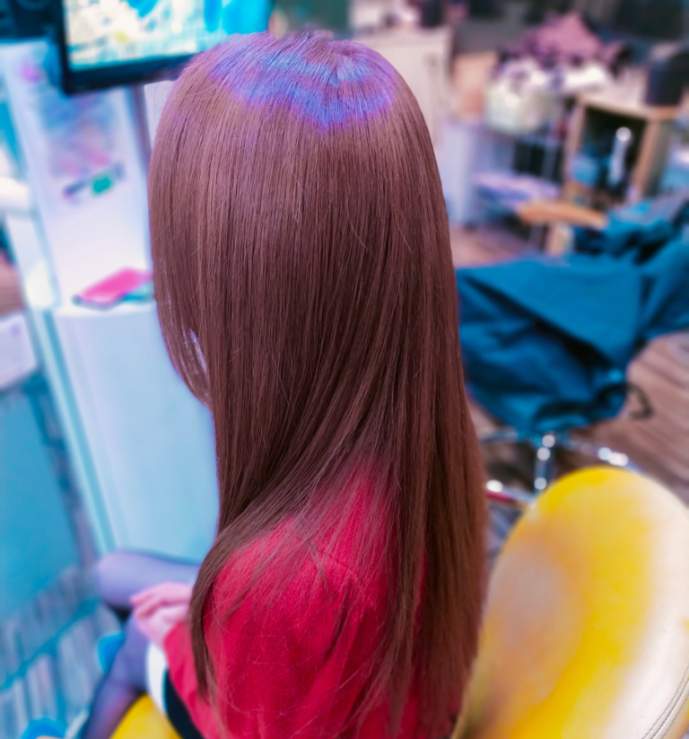 arm’s hairの施術写真